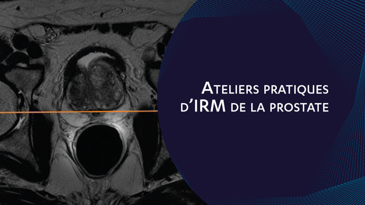 Ateliers Pratiques Dirm De La Prostate Forcomed 6513