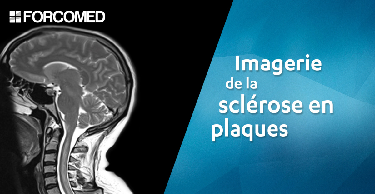 Imagerie de la sclérose en plaques