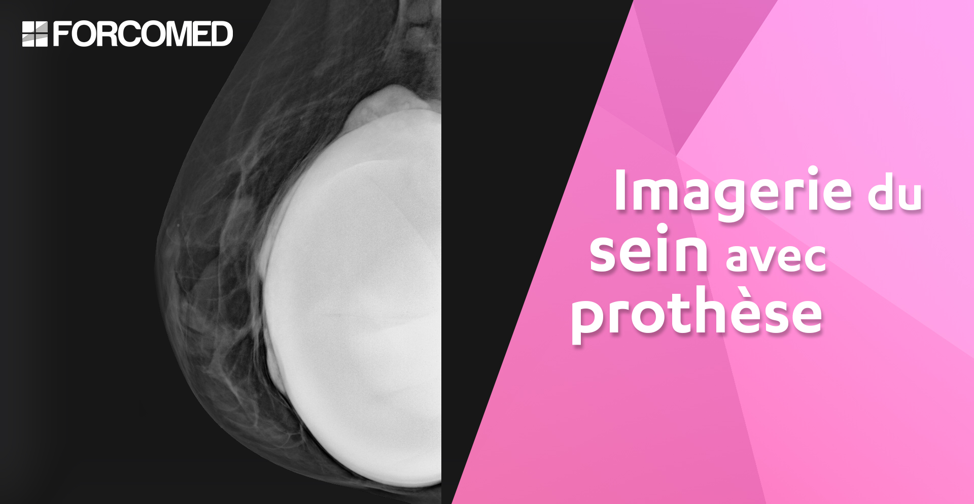 Imagerie du sein avec prothèse